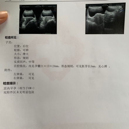 怀孕7个月胎儿图