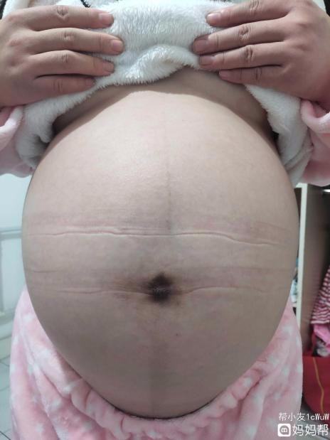 怀孕9个月时孕妈妈应该接受哪些检查呢？
