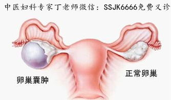 取卵后来月经一直不干净