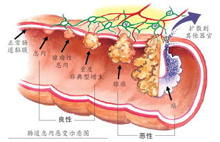 卵黄囊4mm没胎心胎芽正常吗