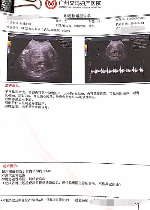 nt检查和唐氏筛查区别