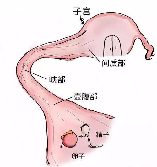 宫外孕保守治疗后出血需多长时间才停止？