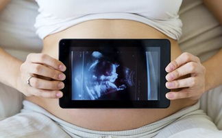 高龄孕妇怀孕期间要做哪些检查