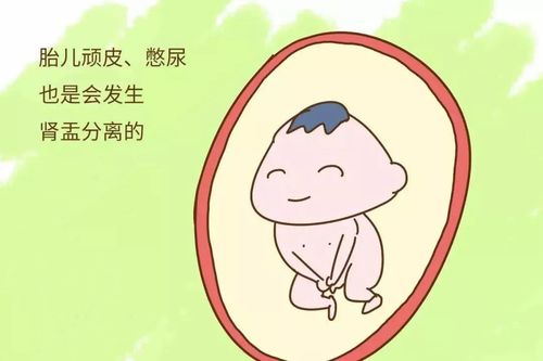 胎儿肾盂分离是男孩吗