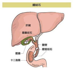 侧切的概率有多高