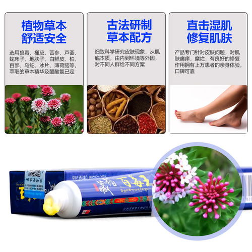 孕妇皮肤痒可以擦药膏吗有用吗