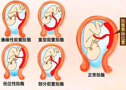 请问多久能看到孕囊啊？