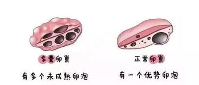 正常卵泡多大会排出体内？