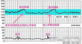 是不是孕晚期后胎心率会越来越低的