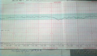 胎心监护结果好差，怎么办啊，哭