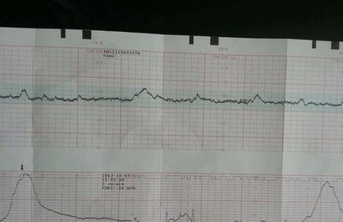 胎心监护结果好差，怎么办啊，哭