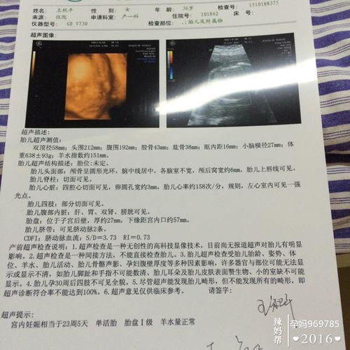 孕24周四维彩超左心室有强光点怎么回事