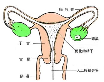 备孕期排卵后需要注意什么