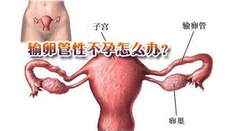 中国不孕不育患者数已超5000万