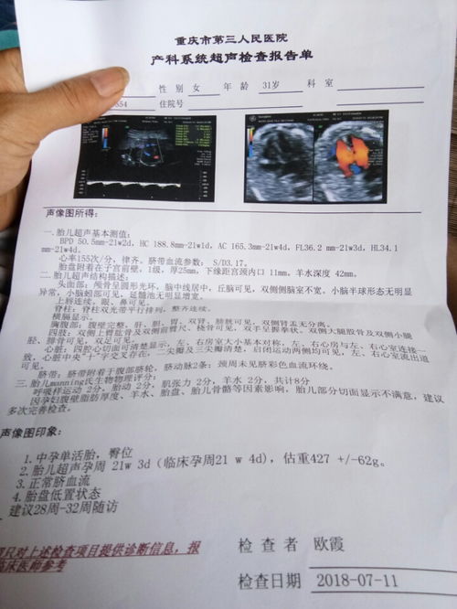 四维彩超怎么预约及检查时机