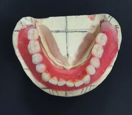 儿童牙齿矫正的检查步骤