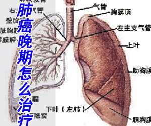 小儿睾丸肿瘤-卵黄囊瘤