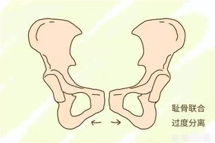 胎头位于耻骨上是什么位置的