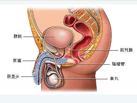 慢性盆腔炎要住院吗?