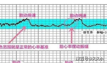 胎心监护多久做一次比较好