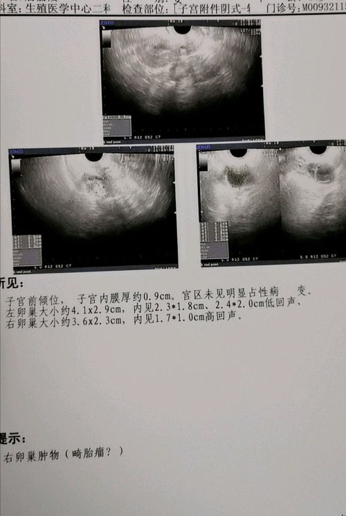 卵泡小能怀孕吗