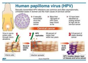 hpv和tct最佳检查时间费用