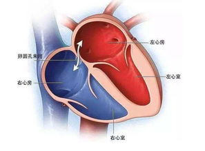 胎儿卵圆孔正常值表格