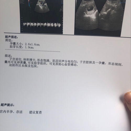 tct和hpv检查后出血几天正常吗