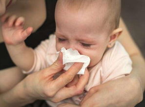 宝宝流鼻涕应该吃些什么药？