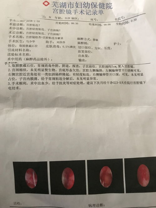 宫腔粘连月经量少怎么办,不需要孩子