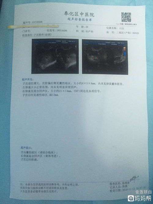 我怀孕43天 为什么阴超做不出孕囊