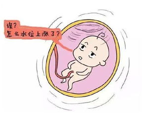孕期羊水过少有哪些症状表现