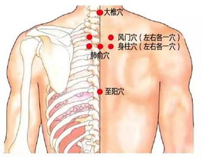 风湿性心脏病患者可以使用三伏贴吗？