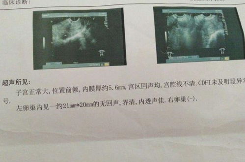 怀孕三个月不告诉是迷信吗