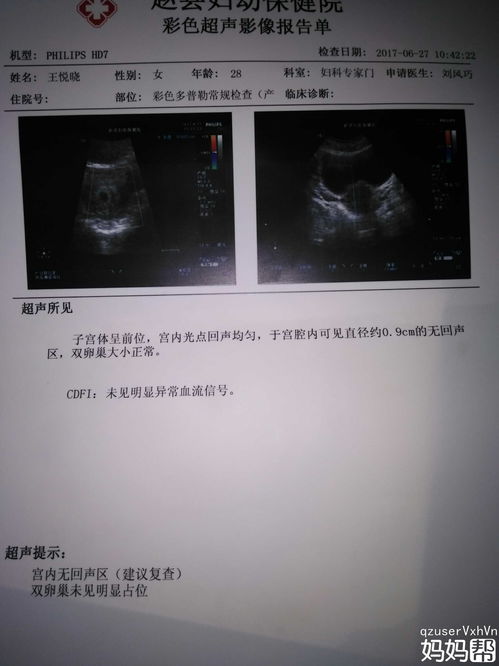 怀孕十五周的胚囊大小是多少