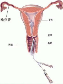 输卵管堵塞来月经有什么症状