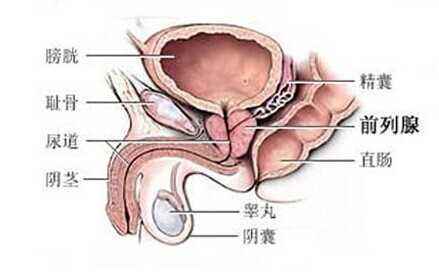 前列腺炎会对身体造成哪些危害