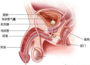 前列腺炎会对身体造成哪些危害