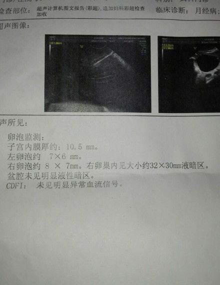 2个月孕，孕囊周边有不规则液性暗区，有危险吗