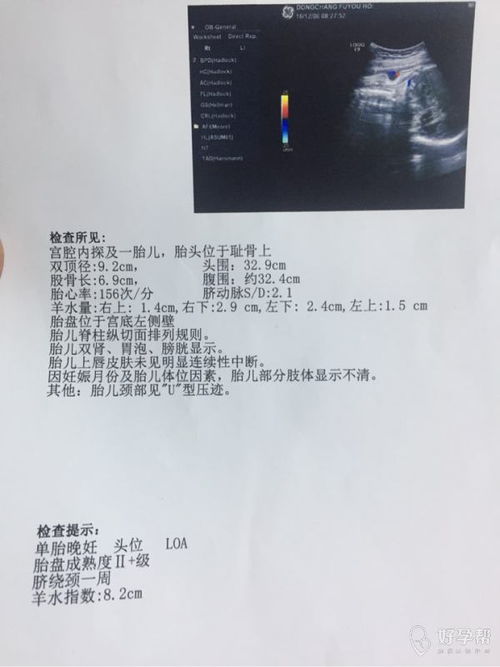 怀孕40周羊水指数正常值是多少？