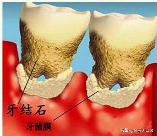 假牙什么材料比较好，或者还比较便宜一点的