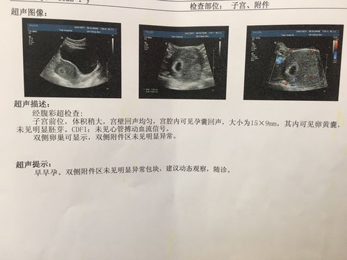 怀孕44天，照B超约10*7mm妊娠囊回声，囊内未见卵黄囊及胚芽组织，是不好吗？