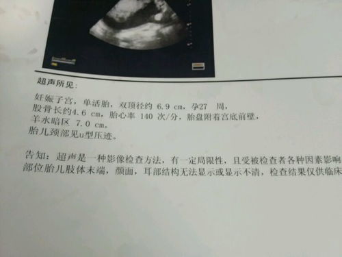 18周双顶径和股骨长相差多少正常