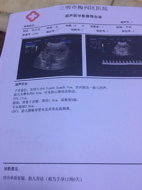 怀孕12周，nt值3mm正常吗？