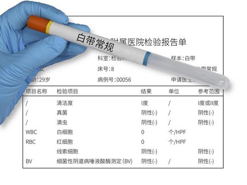 白带清洁度三个杠是什么意思