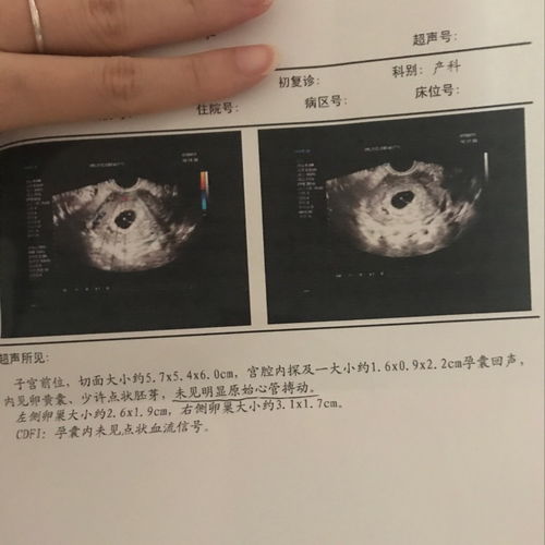 我怀孕6周囊内未见卵黄囊及胚芽这是正常吗