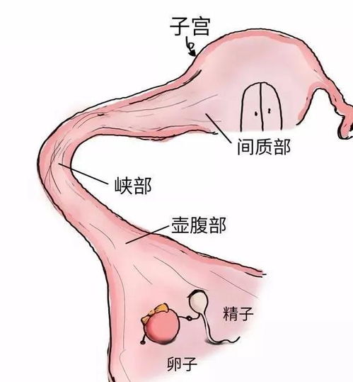 我宫外孕做的是腹腔镜手术