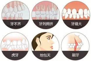 烤瓷牙矫正牙齿效果怎么样？