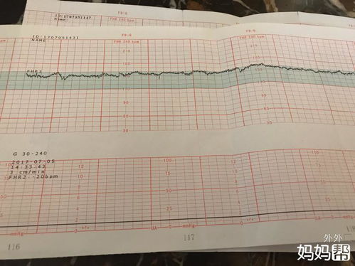 怀孕快五个月了为什么胎动在肚脐下下方动？