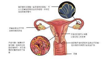 二胎快速怀孕的好方法